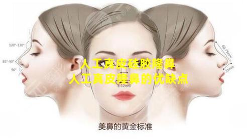 人工真皮硅胶隆鼻 人工真皮隆鼻的优缺点